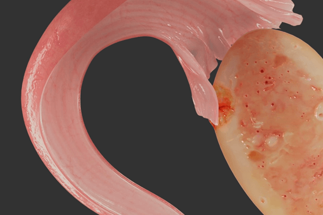 Evvy blog cover - Vaginal microbiome and fertility