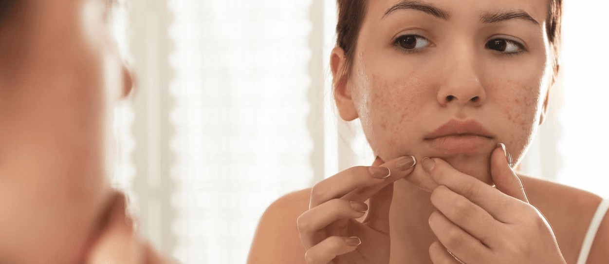 Woman examining skin in mirror