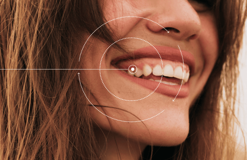 Woman smiling showing healthy teeth