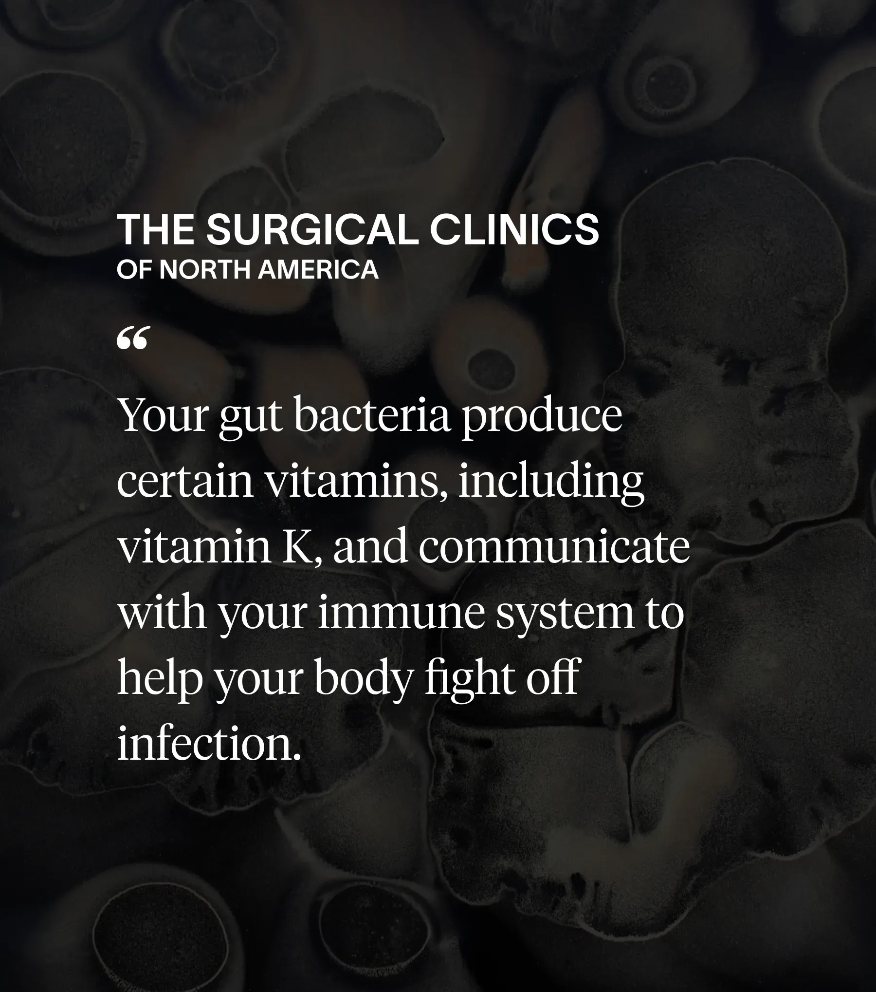 Gut dysbiosis research visualization 1