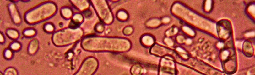 Microscopic view of microorganisms