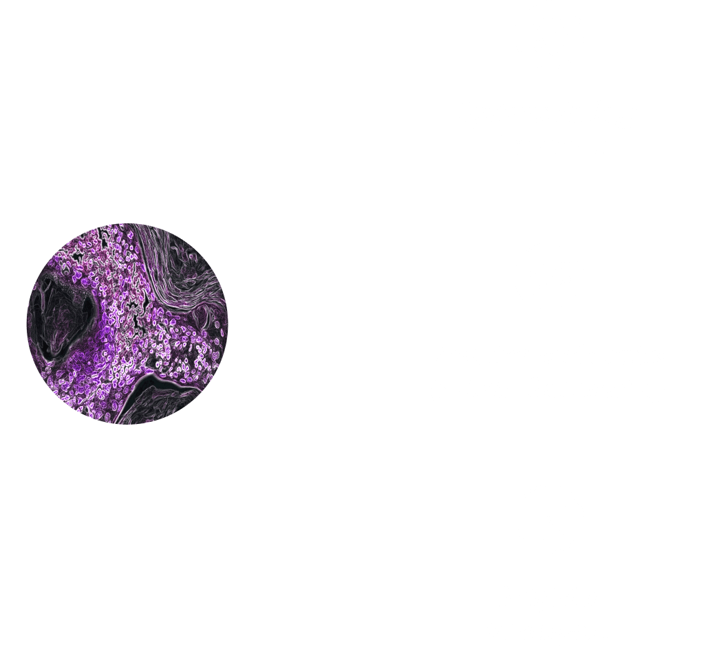 how can i increase glutathione in my body The Adipokine Hypothesis of Heart Failure With a Preserved Ejection  Fraction: A Novel Framework to Explain Pathogenesis and Guide Treatment