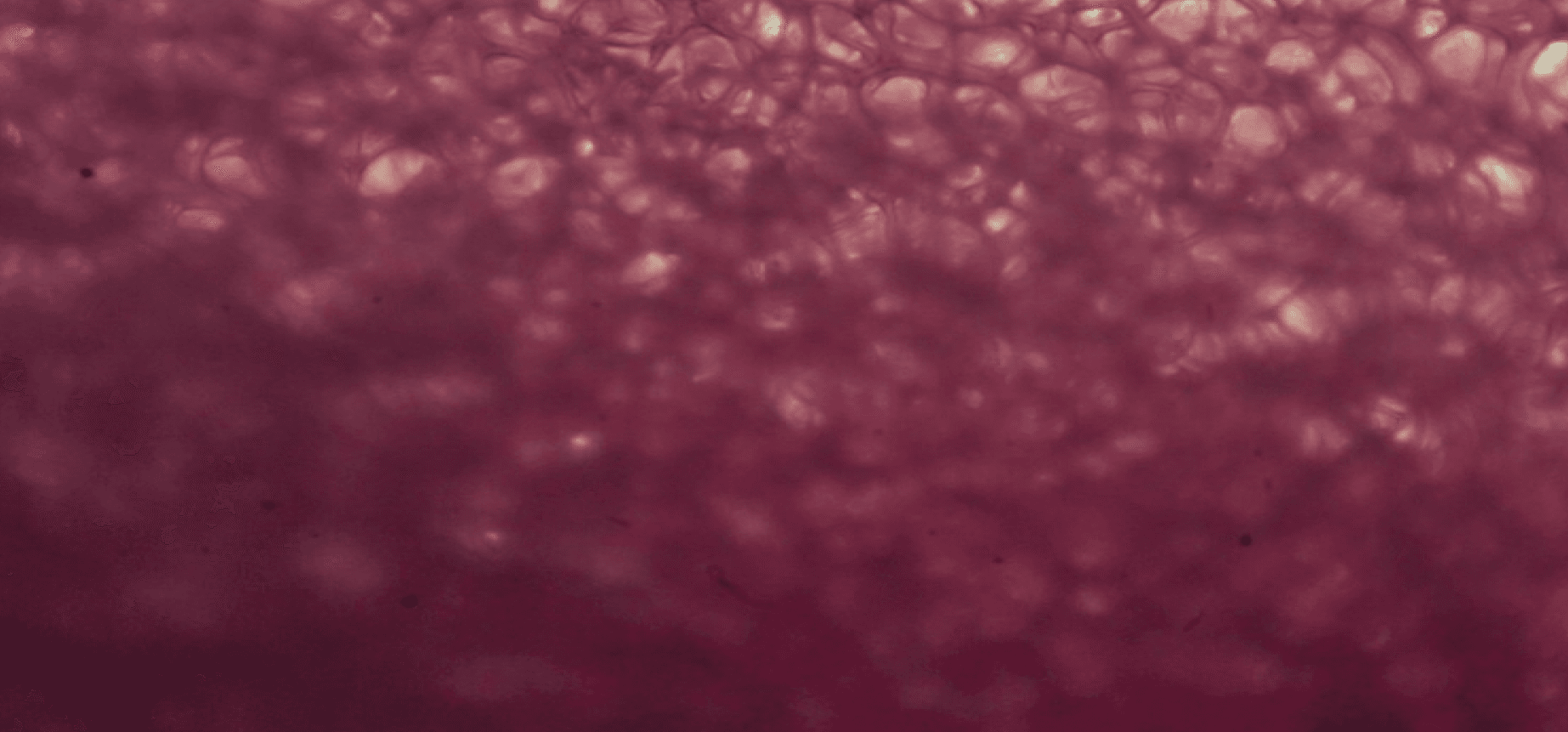 Metatranscriptomic Sequencing Technology background