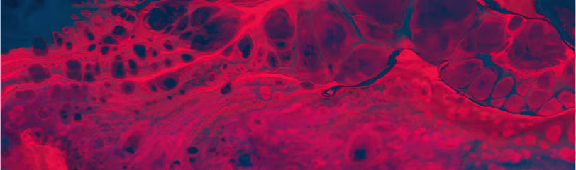 Address inflammaging at the root